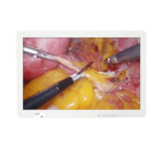 4K UHD Medical Endoscope Monitor 43"