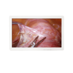 Medical FHD Endoscope Monitor 32＂