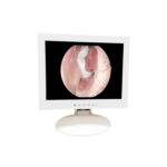 Medical Endoscope Monitor 15＂
