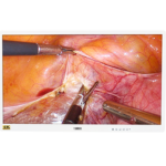 4K UHD Medical Endoscope Monitor 55”