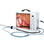 Portable FHD Endoscope Camera Unit 17"